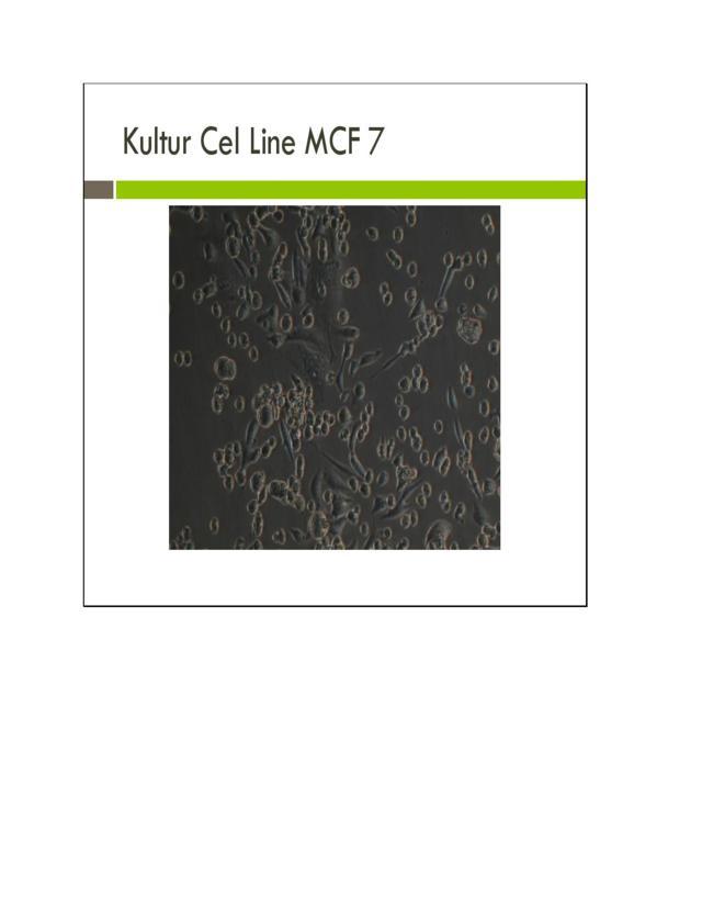 Tes untuk diagnosis penyakit autoimun. Hasil Penelitian